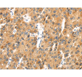 Immunohistochemistry - MACC1 Antibody from Signalway Antibody (43136) - Antibodies.com