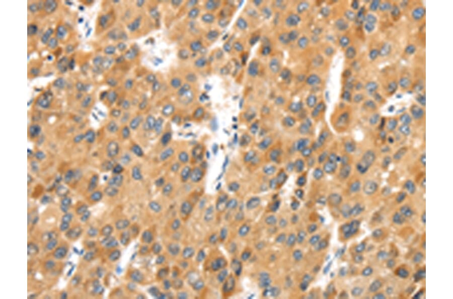 Immunohistochemistry - MACC1 Antibody from Signalway Antibody (43136) - Antibodies.com