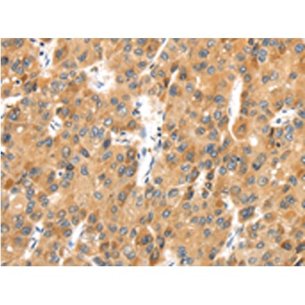 Immunohistochemistry - MACC1 Antibody from Signalway Antibody (43136) - Antibodies.com