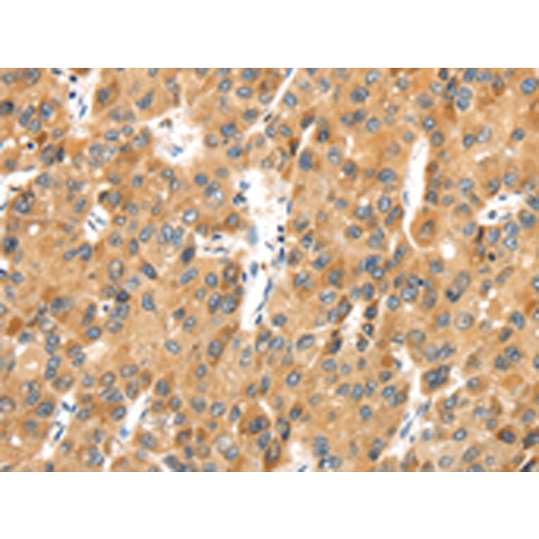 Immunohistochemistry - MACC1 Antibody from Signalway Antibody (43136) - Antibodies.com