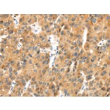 Immunohistochemistry - MACC1 Antibody from Signalway Antibody (43136) - Antibodies.com