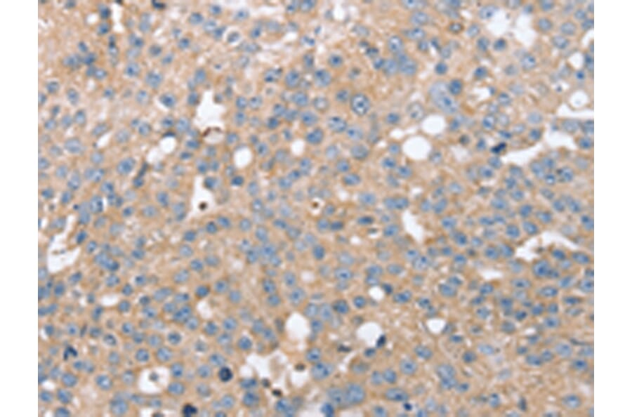 Immunohistochemistry - STK36 Antibody from Signalway Antibody (43148) - Antibodies.com