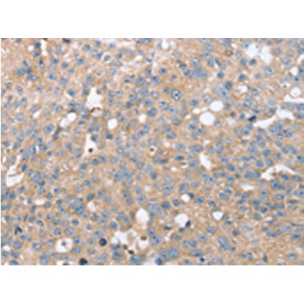 Immunohistochemistry - STK36 Antibody from Signalway Antibody (43148) - Antibodies.com