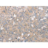 Immunohistochemistry - STK36 Antibody from Signalway Antibody (43148) - Antibodies.com