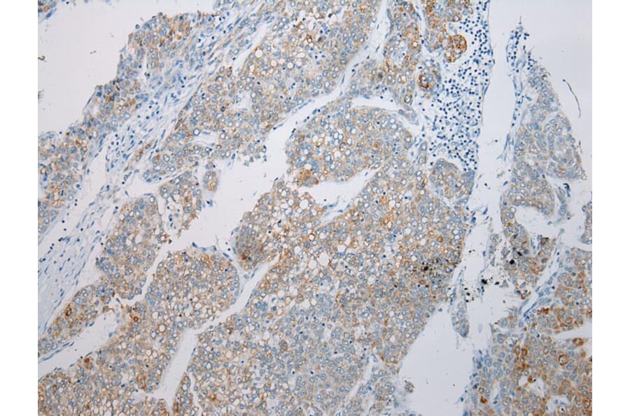 Immunohistochemistry - MGST1 Antibody from Signalway Antibody (43149) - Antibodies.com