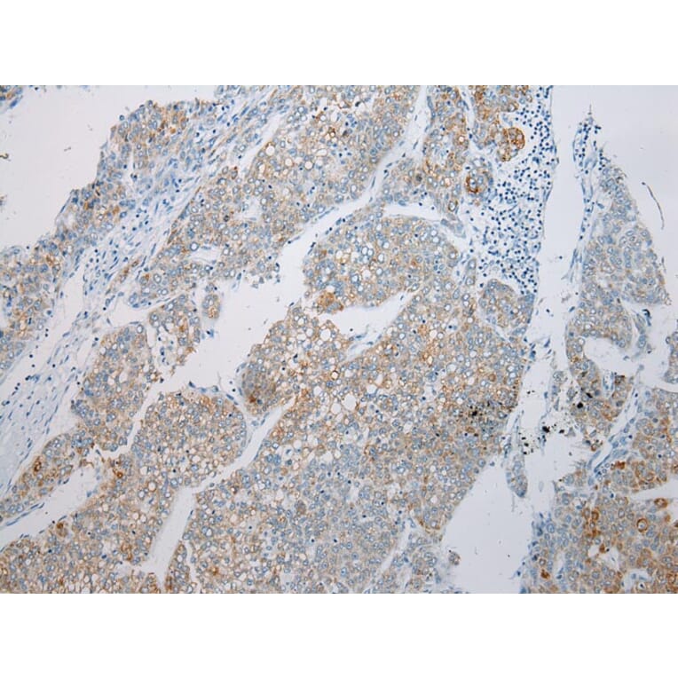 Immunohistochemistry - MGST1 Antibody from Signalway Antibody (43149) - Antibodies.com