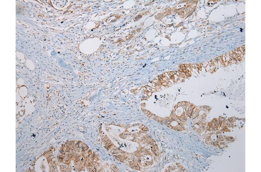 Immunohistochemistry - MGST1 Antibody from Signalway Antibody (43149) - Antibodies.com