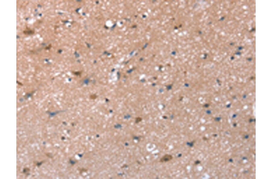 Immunohistochemistry - SYNPO Antibody from Signalway Antibody (43151) - Antibodies.com