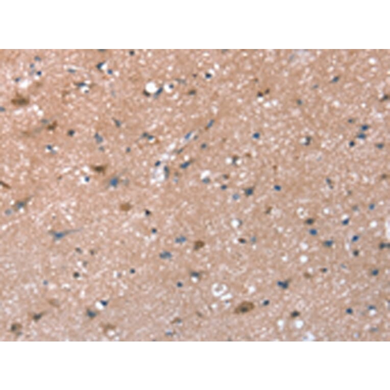 Immunohistochemistry - SYNPO Antibody from Signalway Antibody (43151) - Antibodies.com