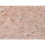 Immunohistochemistry - SYNPO Antibody from Signalway Antibody (43151) - Antibodies.com