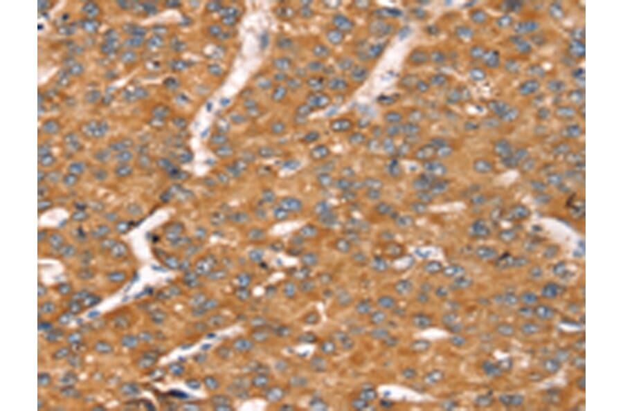 Immunohistochemistry - TGFB2 Antibody from Signalway Antibody (43158) - Antibodies.com