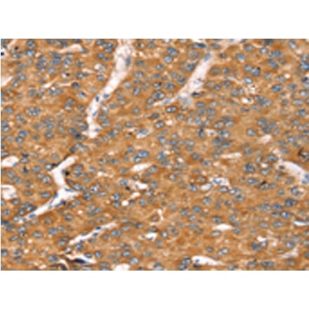 Immunohistochemistry - TGFB2 Antibody from Signalway Antibody (43158) - Antibodies.com