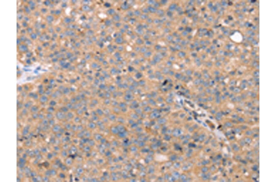 Immunohistochemistry - TGFB2 Antibody from Signalway Antibody (43158) - Antibodies.com