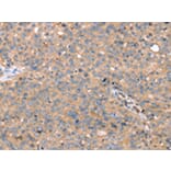 Immunohistochemistry - TGFB2 Antibody from Signalway Antibody (43158) - Antibodies.com