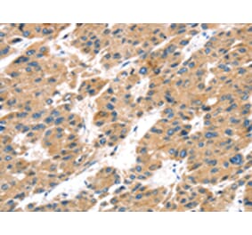 Immunohistochemistry - TRPV5 Antibody from Signalway Antibody (43169) - Antibodies.com