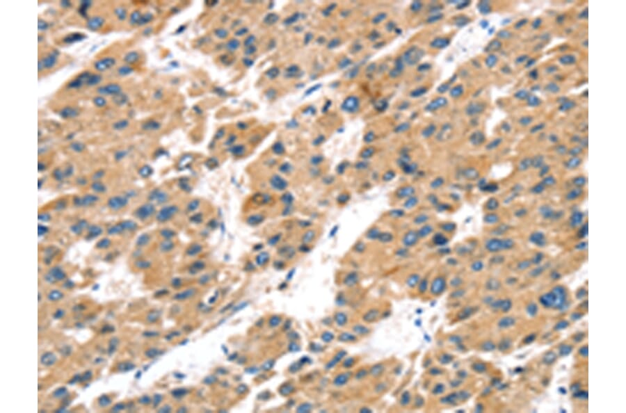 Immunohistochemistry - TRPV5 Antibody from Signalway Antibody (43169) - Antibodies.com
