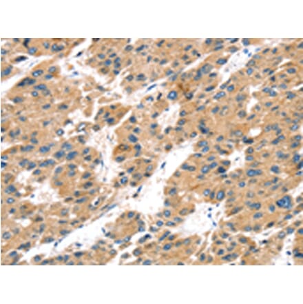 Immunohistochemistry - TRPV5 Antibody from Signalway Antibody (43169) - Antibodies.com
