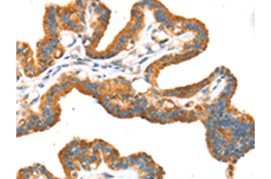 Immunohistochemistry - TRPV5 Antibody from Signalway Antibody (43169) - Antibodies.com