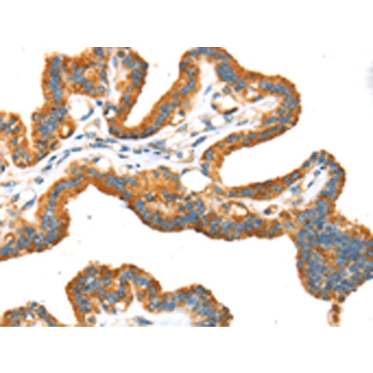 Immunohistochemistry - TRPV5 Antibody from Signalway Antibody (43169) - Antibodies.com