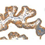 Immunohistochemistry - TRPV5 Antibody from Signalway Antibody (43169) - Antibodies.com