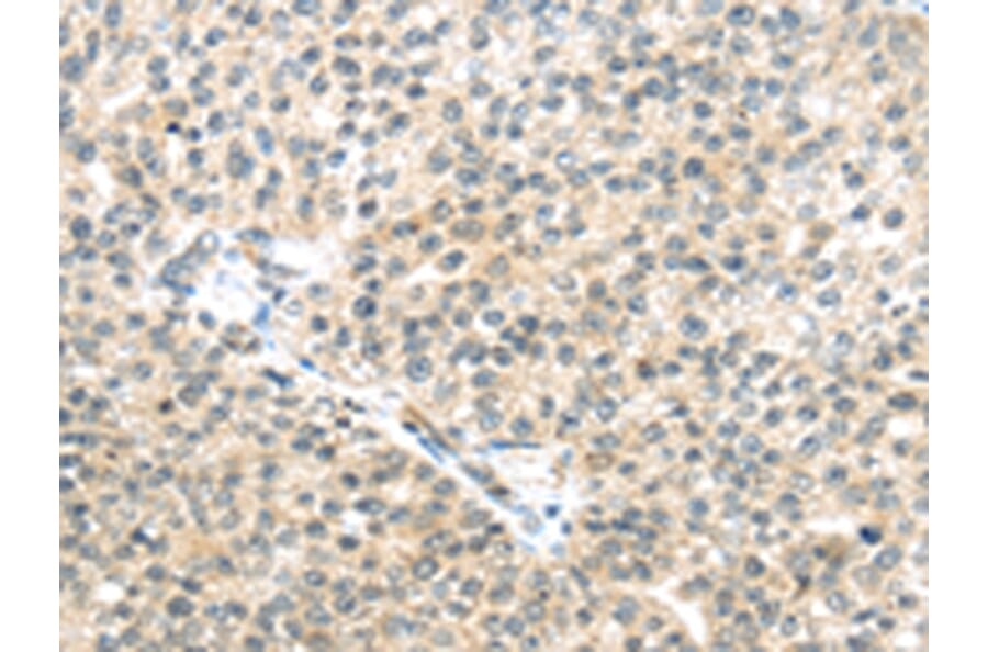 Immunohistochemistry - TTBK2 Antibody from Signalway Antibody (43172) - Antibodies.com