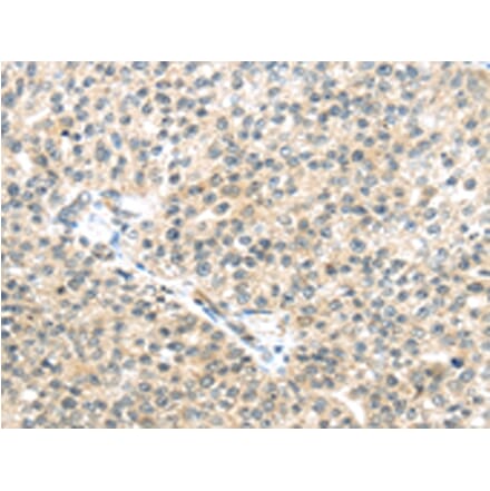 Immunohistochemistry - TTBK2 Antibody from Signalway Antibody (43172) - Antibodies.com