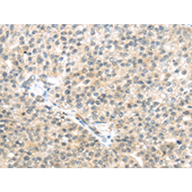 Immunohistochemistry - TTBK2 Antibody from Signalway Antibody (43172) - Antibodies.com