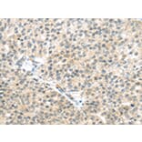 Immunohistochemistry - TTBK2 Antibody from Signalway Antibody (43172) - Antibodies.com