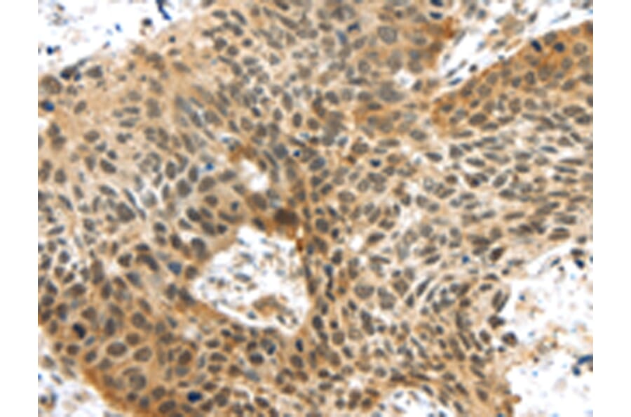 Immunohistochemistry - TTBK2 Antibody from Signalway Antibody (43172) - Antibodies.com