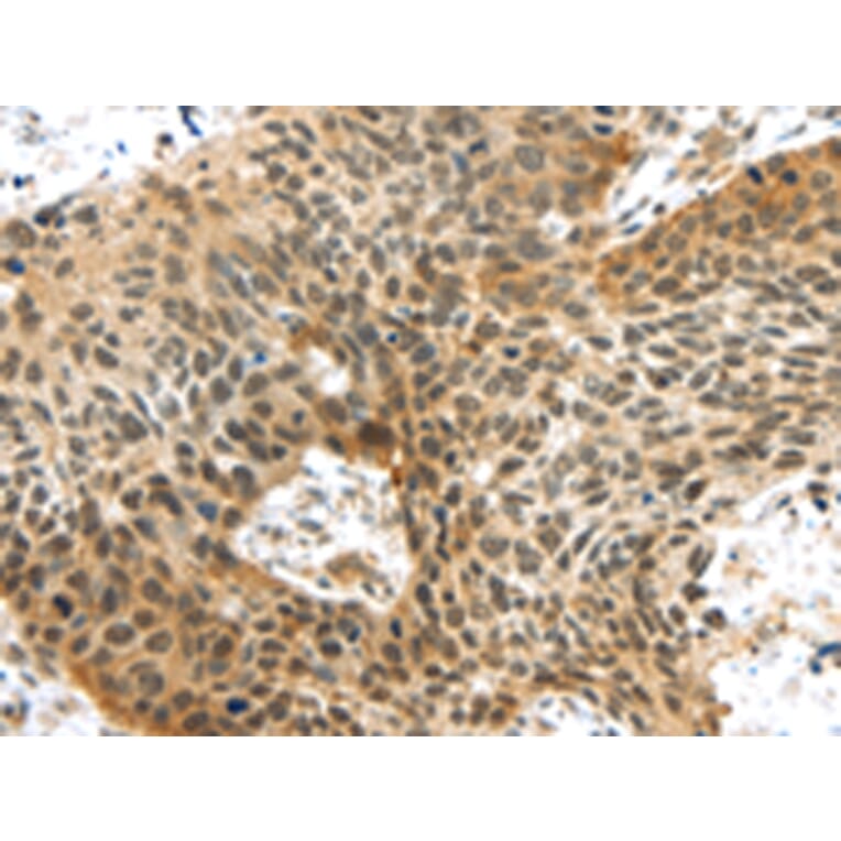 Immunohistochemistry - TTBK2 Antibody from Signalway Antibody (43172) - Antibodies.com