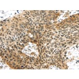 Immunohistochemistry - TTBK2 Antibody from Signalway Antibody (43172) - Antibodies.com