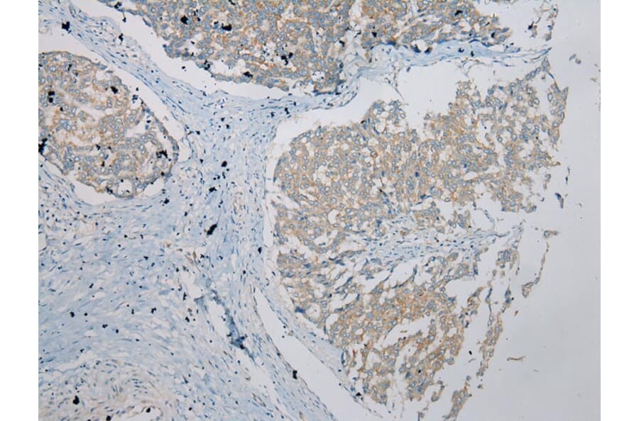 Immunohistochemistry - UBTD2 Antibody from Signalway Antibody (43175) - Antibodies.com