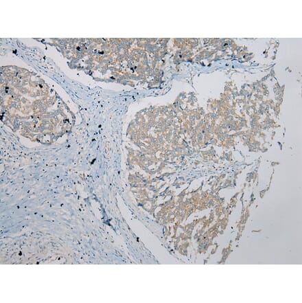 Immunohistochemistry - UBTD2 Antibody from Signalway Antibody (43175) - Antibodies.com