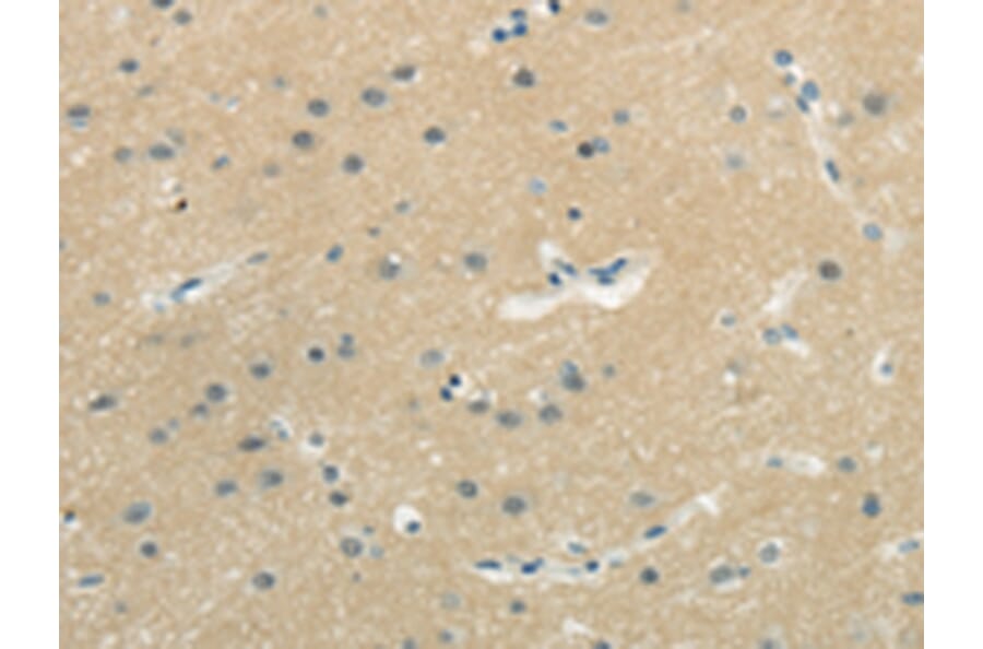 Immunohistochemistry - WASF3 Antibody from Signalway Antibody (43182) - Antibodies.com