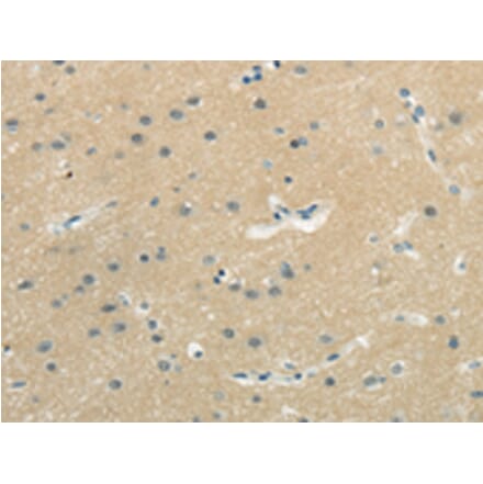 Immunohistochemistry - WASF3 Antibody from Signalway Antibody (43182) - Antibodies.com
