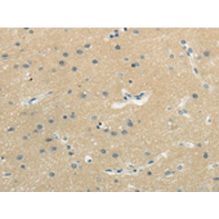 Immunohistochemistry - WASF3 Antibody from Signalway Antibody (43182) - Antibodies.com