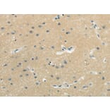 Immunohistochemistry - WASF3 Antibody from Signalway Antibody (43182) - Antibodies.com