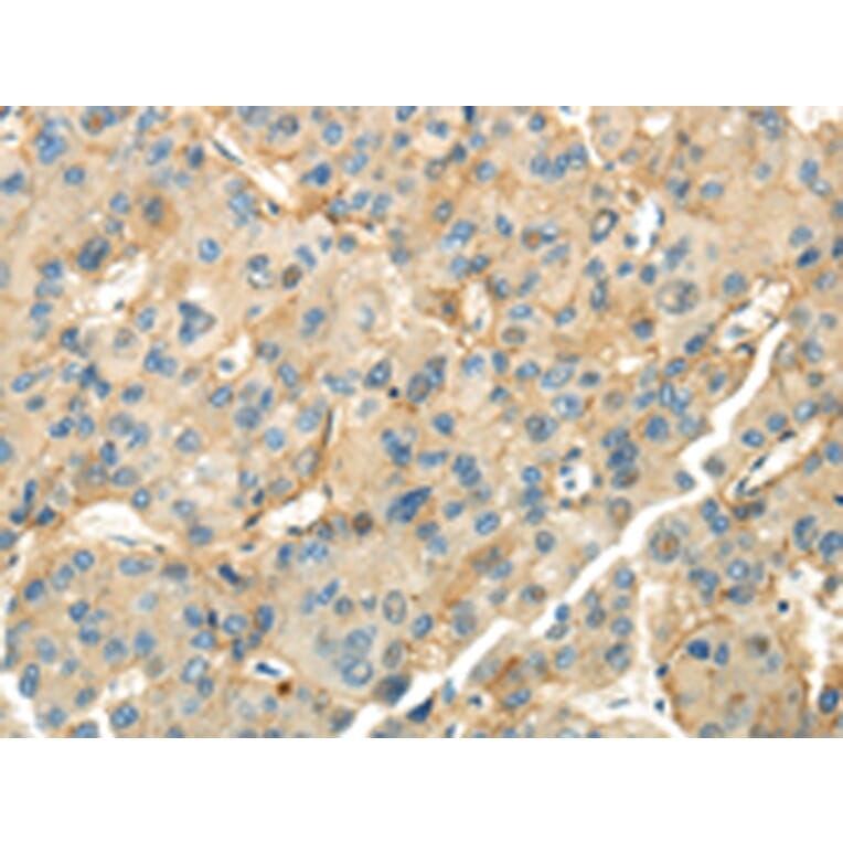 Immunohistochemistry - CD70 Antibody from Signalway Antibody (43184) - Antibodies.com