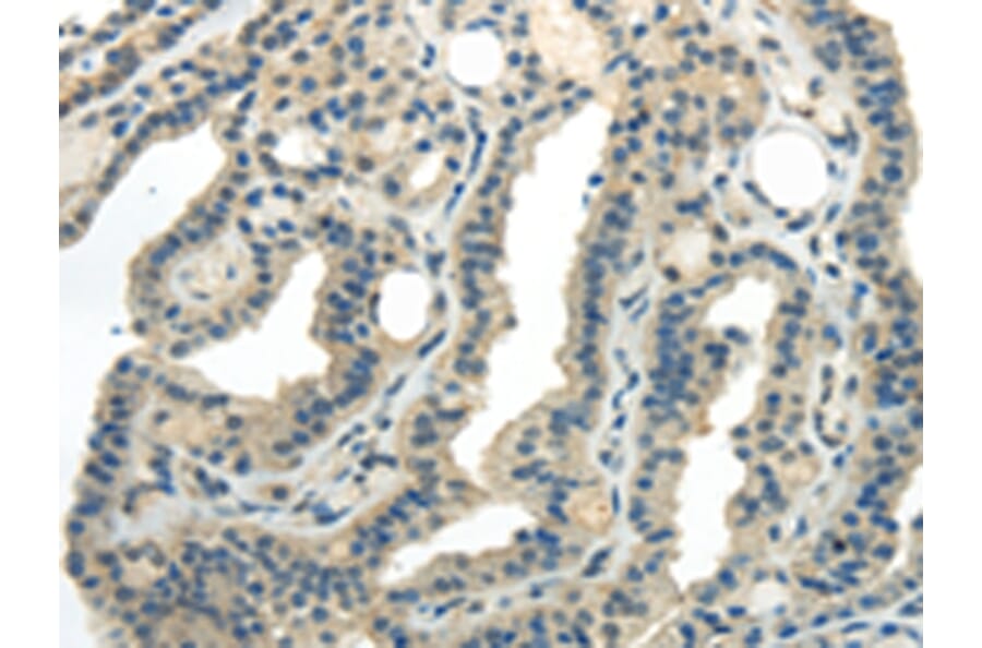 Immunohistochemistry - CD70 Antibody from Signalway Antibody (43184) - Antibodies.com