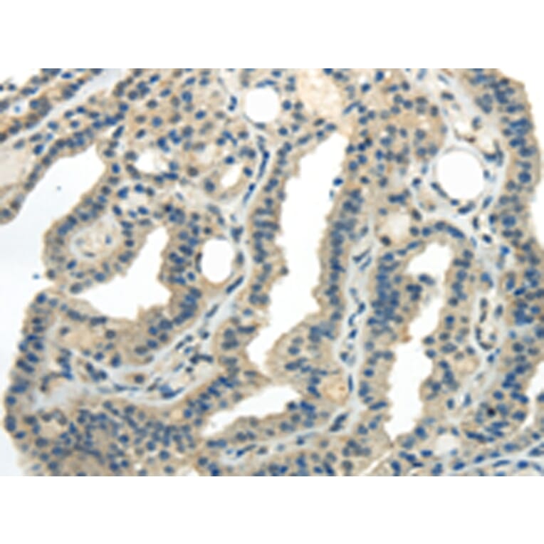Immunohistochemistry - CD70 Antibody from Signalway Antibody (43184) - Antibodies.com