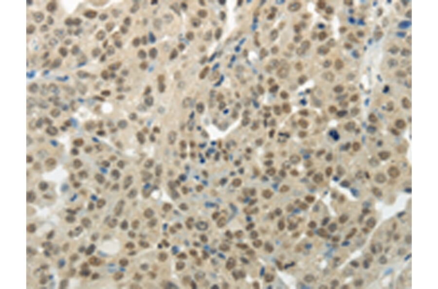 Immunohistochemistry - BAZ1B Antibody from Signalway Antibody (43197) - Antibodies.com