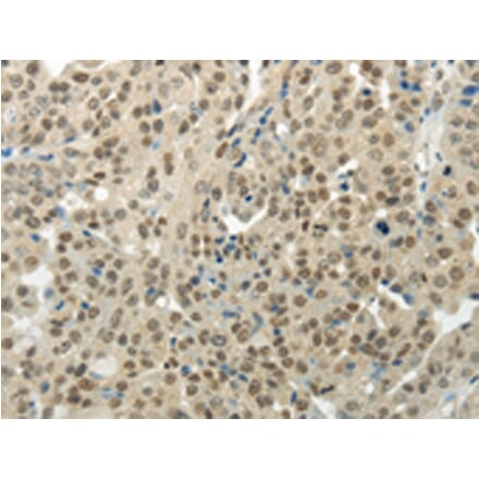 Immunohistochemistry - BAZ1B Antibody from Signalway Antibody (43197) - Antibodies.com