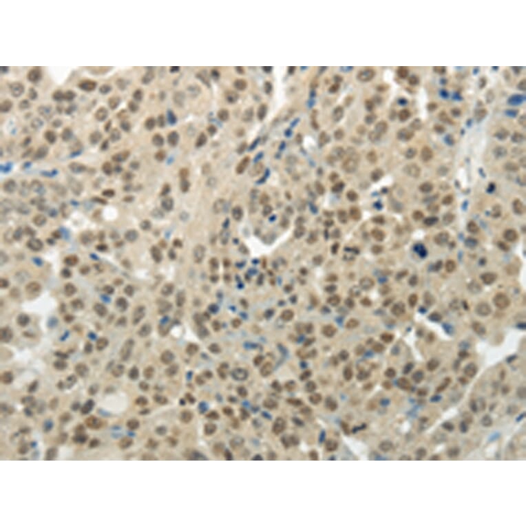 Immunohistochemistry - BAZ1B Antibody from Signalway Antibody (43197) - Antibodies.com