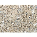 Immunohistochemistry - BAZ1B Antibody from Signalway Antibody (43197) - Antibodies.com