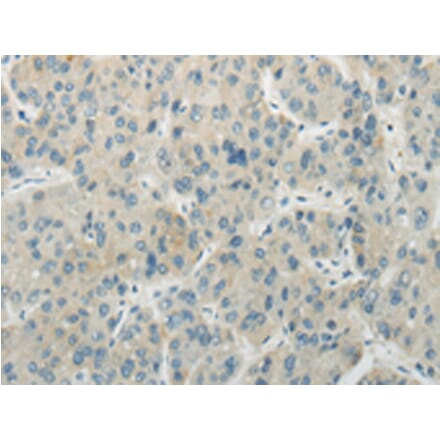 Immunohistochemistry - AICDA Antibody from Signalway Antibody (43199) - Antibodies.com