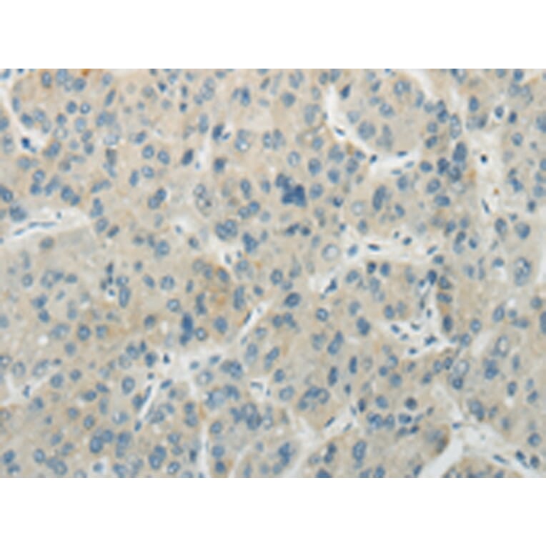 Immunohistochemistry - AICDA Antibody from Signalway Antibody (43199) - Antibodies.com