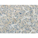 Immunohistochemistry - AICDA Antibody from Signalway Antibody (43199) - Antibodies.com