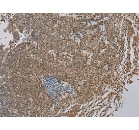 Immunohistochemistry - ZBTB2 Antibody from Signalway Antibody (43204) - Antibodies.com