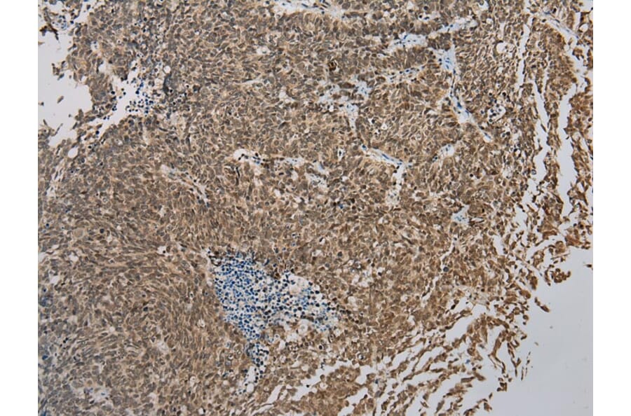 Immunohistochemistry - ZBTB2 Antibody from Signalway Antibody (43204) - Antibodies.com