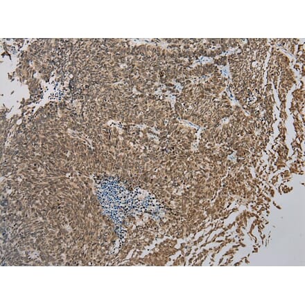 Immunohistochemistry - ZBTB2 Antibody from Signalway Antibody (43204) - Antibodies.com